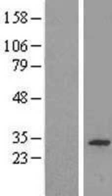 Western Blot: CWC15 Overexpression Lysate (Adult Normal) [NBL1-09617] Left-Empty vector transfected control cell lysate (HEK293 cell lysate); Right -Over-expression Lysate for CWC15.