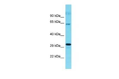 Western Blot: CWF19L1 Antibody [NBP2-87229] - Host: Rabbit. Target Name: CWF19L1. Sample Type: Hela Whole cell lysates. Antibody Dilution: 1.0ug/ml