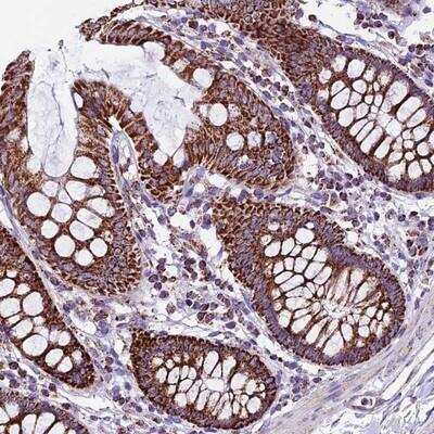 Immunohistochemistry-Paraffin: CX3CL1/Fractalkine Antibody [NBP1-89309] - Staining of human colon shows strong cytoplasmic positivity with granular pattern in glandular cells.