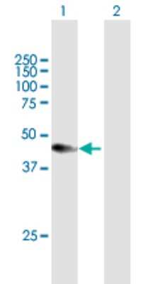 Western Blot: CXADR Antibody [H00001525-B01P] - Analysis of CXADR expression in transfected 293T cell line by CXADR polyclonal antibody.  Lane 1: CXADR transfected lysate(40.15 KDa). Lane 2: Non-transfected lysate.
