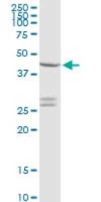 Western Blot: CXADR Antibody [H00001525-D01P] - Analysis of CXADR expression in Jurkat.