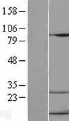 Western Blot: CXCL10/INP10 Overexpression Lysate (Adult Normal) [NBL1-09621] Left-Empty vector transfected control cell lysate (HEK293 cell lysate); Right -Over-expression Lysate for CXCL10/INP10.