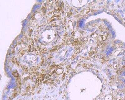 Immunohistochemistry-Paraffin: CXCL12/SDF-1 Antibody [NBP2-89133] - Analysis of paraffin-embedded human placenta tissue using anti-SDF1 antibody. Counter stained with hematoxylin.