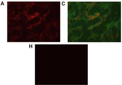 Immunohistochemistry: CXCL14/BRAK Antibody [NBP1-31398] - Two-color immunofluorescence staining of primary colon cancer tissue with anti-CXCL14 and BerEP4. (A) Anti-CXCL14  red color. (C) Overlays giving yellow color of double-stained areas (BerEP4, green color). (H) Rabbit IgG; negative control for anti-CXCL14. Original magnification: 200x.  Image collected and cropped by CiteAb from the following publication (mdpi.com/1422-0067/20/22/5793) licensed under a CC-BY license.