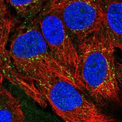 Immunocytochemistry/Immunofluorescence: CXCL16 Antibody [NBP2-58349] - Staining of human cell line CACO-2 shows localization to vesicles.