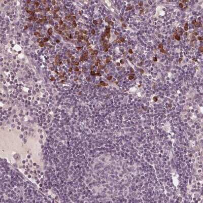 Immunohistochemistry: CXCL16 Antibody [NBP2-39072] - Staining of human lymph node shows strong cytoplasmic positivity in a subset of non-germinal center cells.