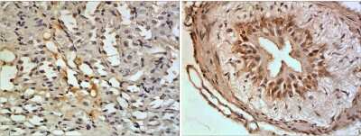 Immunohistochemistry-Paraffin: CXCL16 Antibody (RM0208-15Q2) [NBP2-12226] - The Kidney tissue samples from the Folic Acid induced kidney injury model were fixed using 4% PFA at 4C for overnight and embeded in paraffin. 4um section was sublected to IHC with NBP2-12226