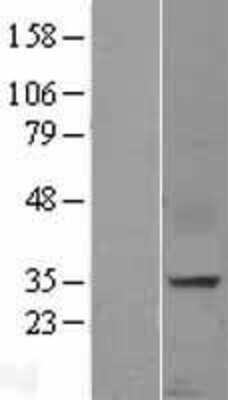 Western Blot: CXCL16 Overexpression Lysate (Adult Normal) [NBP2-08263] Left-Empty vector transfected control cell lysate (HEK293 cell lysate); Right -Over-expression Lysate for CXCL16.