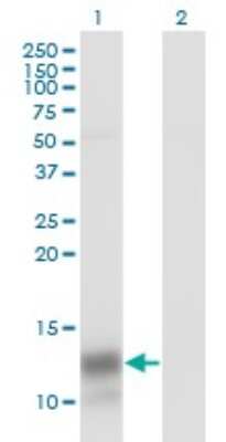Western Blot: CXCL4/PF4 Antibody (3F6) [H00005196-M01] - Analysis of PF4 expression in transfected 293T cell line by PF4 monoclonal antibody (M01), clone 3F6.Lane 1: PF4 transfected lysate(10.8 KDa).Lane 2: Non-transfected lysate.