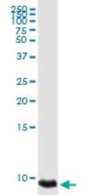 Western Blot: CXCL4/PF4 Antibody [H00005196-D01P] - Analysis of PF4 expression in A-431.