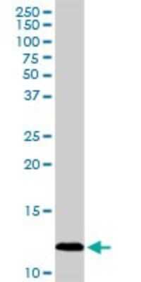 Western Blot: CXCL4/PF4 Antibody [H00005196-D01P] - Analysis of PF4 expression in human spleen.