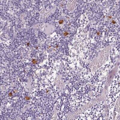 Immunohistochemistry-Paraffin: CXCL5/ENA-78 Antibody [NBP2-39058] - Staining of human lymph node shows strong cytoplasmic positivity in non-germinal center cells.