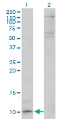 Western Blot: CXCL5 Antibody (M1) [H00006374-M03] - Analysis of CXCL5 expression in transfected 293T cell line by CXCL5 monoclonal antibody (M03), clone M1. Lane 1: CXCL5 transfected lysatE (12 KDa). Lane 2: Non-transfected lysate.