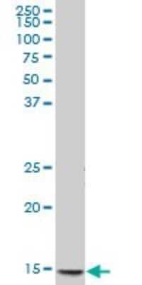 Western Blot: CXCL7/NAP-2 Antibody [H00005473-B01P] - Analysis of PPBP expression in human spleen.