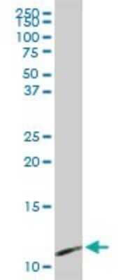Western Blot: CXCL7/NAP-2 Antibody [H00005473-D01P] - Analysis of PPBP expression in human spleen.