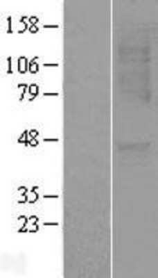 Western Blot: CXCR1 Overexpression Lysate (Adult Normal) [NBL1-11968] Left-Empty vector transfected control cell lysate (HEK293 cell lysate); Right -Over-expression Lysate for CXCR1.