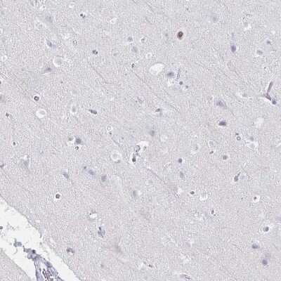 Immunohistochemistry-Paraffin: CXCR2/IL-8RB Antibody [NBP2-38197] - Staining of human cerebral cortex shows no positivity in neurons.