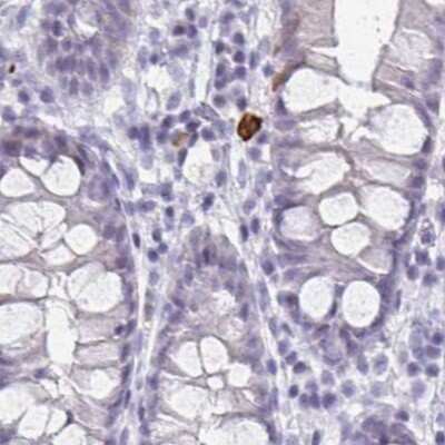 Immunohistochemistry-Paraffin: CXCR2/IL-8RB Antibody [NBP2-38197] - Staining of human colon.