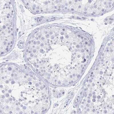 Immunohistochemistry-Paraffin: CXCR2/IL-8RB Antibody [NBP2-38197] - Staining of human testis shows no cytoplasmic positivity in cells in seminiferous ducts.