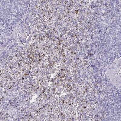 Immunohistochemistry-Paraffin: CXCR2/IL-8RB Antibody [NBP2-38197] - Staining of human spleen shows moderate to strong cytoplasmic positivity in cells in red pulp.