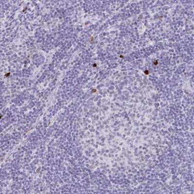 Immunohistochemistry-Paraffin: CXCR2/IL-8RB Antibody [NBP2-38197] - Staining of human lymph node shows moderate to strong cytoplasmic positivity in non-germinal center cells.
