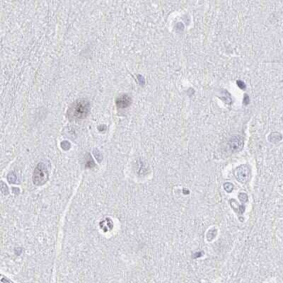 Immunohistochemistry-Paraffin: CXCR2/IL-8RB Antibody [NBP2-38197] - Staining of human cerebral cortex using Anti-CXCR2 antibody NBP2-38197.
