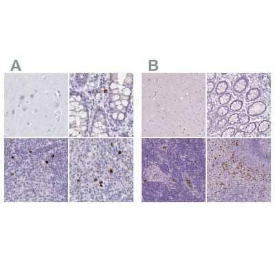 Immunohistochemistry-Paraffin: CXCR2/IL-8RB Antibody [NBP2-38197] - Staining of human cerebral cortex, colon, lymph node and spleen using Anti-CXCR2 antibody NBP2-38197 (A) shows similar protein distribution across tissues to independent antibody NBP2-38195 (B).