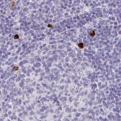 Immunohistochemistry-Paraffin: CXCR2/IL-8RB Antibody [NBP2-38197] - Staining of human lymph node using Anti-CXCR2 antibody NBP2-38197.