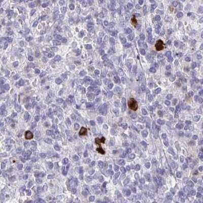 Immunohistochemistry-Paraffin: CXCR2/IL-8RB Antibody [NBP2-38197] - Staining of human spleen using Anti-CXCR2 antibody NBP2-38197.