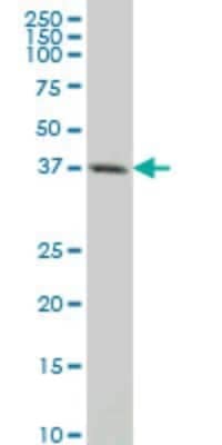 Western Blot: CXCR4 Antibody (1F8) [H00007852-M02] - CXCR4 monoclonal antibody (M02), clone 1F8. Analysis of CXCR4 expression in human Intestinal wall.