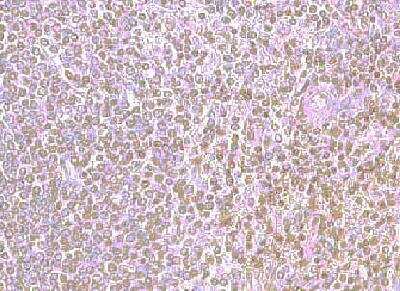 Immunohistochemistry-Paraffin: CXCR4 Antibody [NB100-716] - Human spleen
