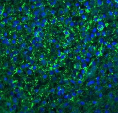 Immunocytochemistry/Immunofluorescence: CXCR6 Antibody [NBP1-76871] - Analysis of Bonzo in human spleen tissue with Bonzo antibody at 20 ug/ml.