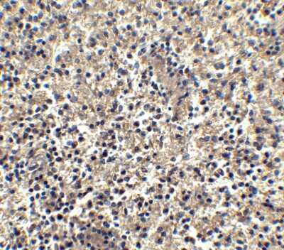 Immunohistochemistry: CXCR6 Antibody [NBP1-76871] - Analysis of Bonzo in human spleen tissue with Bonzo antibody at 2.5 ug/ml.