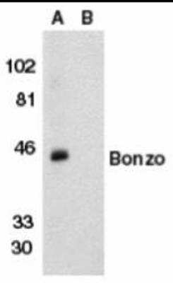 Western Blot: CXCR6 Peptide [NBP1-76871PEP] - Incubating the peptide with equal volume of antibody for 30 min at 37C usually completely blocks the antibody activity in Western blotting.