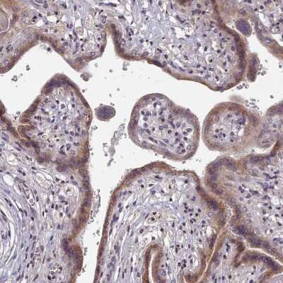 Immunohistochemistry-Paraffin: CXCR7/RDC-1 Antibody [NBP2-13885] - Staining of human placenta shows cytoplasmic positivity in trophoblasts.