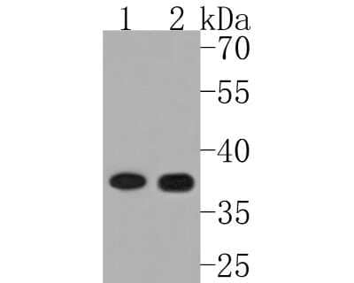 Western Blot: CXCR7/RDC-1 Antibody (SN65-09) [NBP2-67666] - Western blot analysis of CXCR7/RDC-1 on different lysates. Proteins were transferred to a PVDF membrane and blocked with 5% BSA in PBS for 1 hour at room temperature. The primary antibody (1/500) was used in 5% BSA at room temperature for 2 hours. Goat An