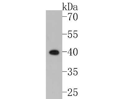 Western Blot: CXCR7/RDC-1 Antibody (SN65-09) [NBP2-67666] - Western blot analysis of CXCR7/RDC-1 on PC-3M cell lysates. Proteins were transferred to a PVDF membrane and blocked with 5% BSA in PBS for 1 hour at room temperature. The primary antibody (1/500) was used in 5% BSA at room temperature for 2 hours. Goat A