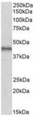 Western Blot: CXCR7/RDC-1 Antibody [NBP2-44325] - Analysis of Human Breast cancer lysate (35ug protein in RIPA buffer).