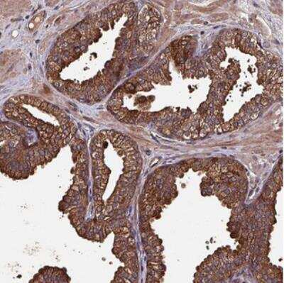 Immunohistochemistry: CXXC Finger Protein 11 Antibody [NBP2-31015] - Staining of human prostate shows strong cytoplasmic and membranous positivity in glandular cells.