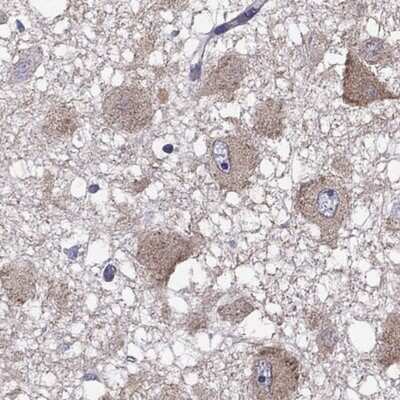 Immunohistochemistry-Paraffin: CXXC Finger Protein 11 Antibody [NBP2-31015] - Staining of human hypothalamus shows strong cytoplasmic positivity in neuronal cells.