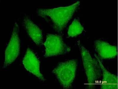 Immunocytochemistry/Immunofluorescence: CXorf21 Antibody [H00080231-B01P] - Analysis of purified antibody to CXorf21 on HeLa cell. (antibody concentration 10 ug/ml)