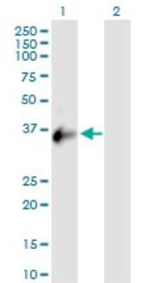 Western Blot CXorf21 Antibody - Azide and BSA Free