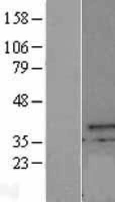 Western Blot: CXorf21 Overexpression Lysate (Adult Normal) [NBL1-09638] Left-Empty vector transfected control cell lysate (HEK293 cell lysate); Right -Over-expression Lysate for CXorf21.