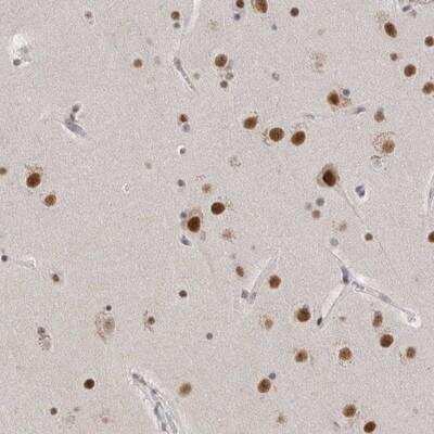 Immunohistochemistry-Paraffin: CXorf23 Antibody [NBP1-86397] - Staining of human cerebral cortex shows strong nuclear positivity in neuronal cells.