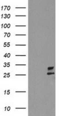 Western Blot PBDC1 Antibody (OTI4E11)