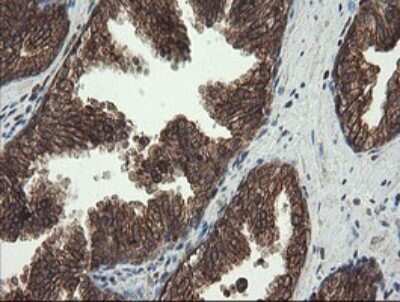 Immunohistochemistry: CXorf26 Antibody (5A11) [NBP2-46410] - Analysis of Human prostate tissue.
