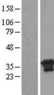 Western Blot PBDC1 Overexpression Lysate