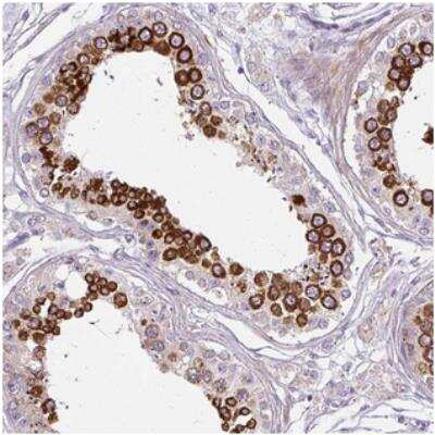Immunohistochemistry: CXorf22 Antibody [NBP2-30729] - Staining of human testis shows strong cytoplasmic positivity in cells in seminiferus ducts.
