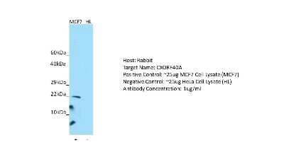 Western Blot: CXorf40A Antibody [NBP2-82786] - Host: Rabbit. Target: CXORF40A. Positive control (+): MCF7 Cell Lysate (N10). Negative control (-): HeLa Cell Lysate (HL). Antibody concentration: 1ug/ml