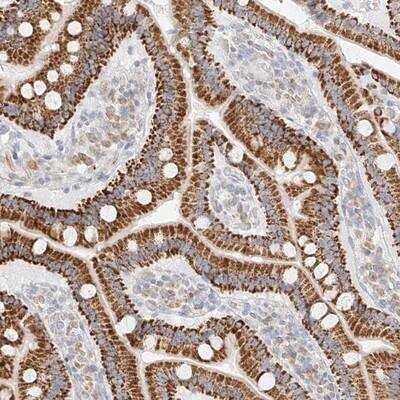 Immunohistochemistry-Paraffin: CXorf58 Antibody [NBP1-93910] - Staining of human duodenum shows strong cytoplasmic positivity in glandular cells.